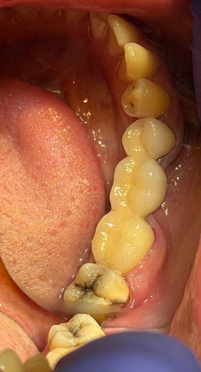 После лечения